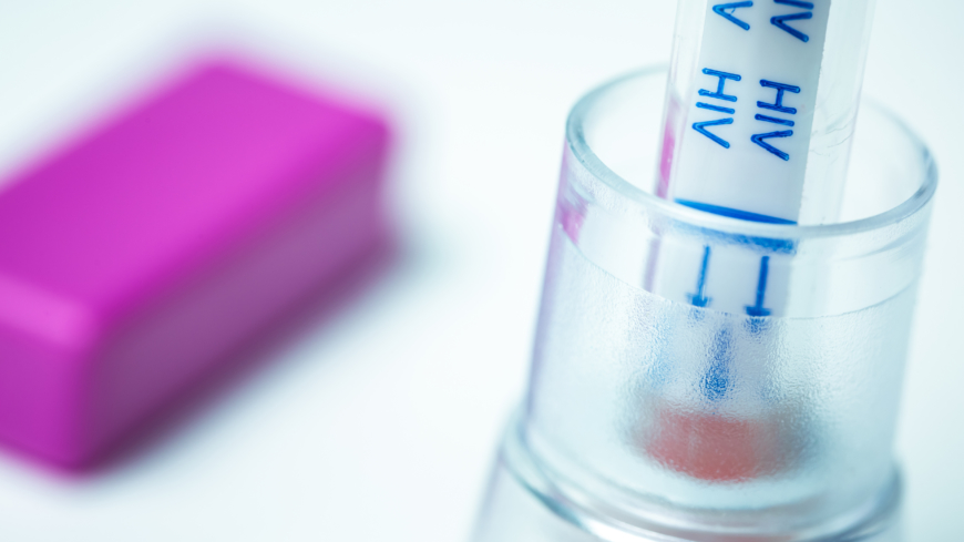 Självtest för hiv snart verklighet för finländarna